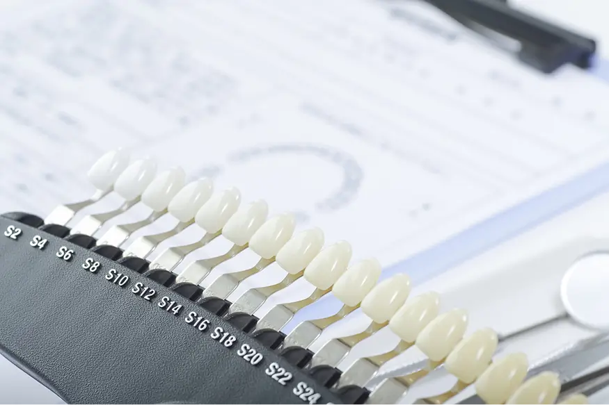 色調チェック・口腔内写真