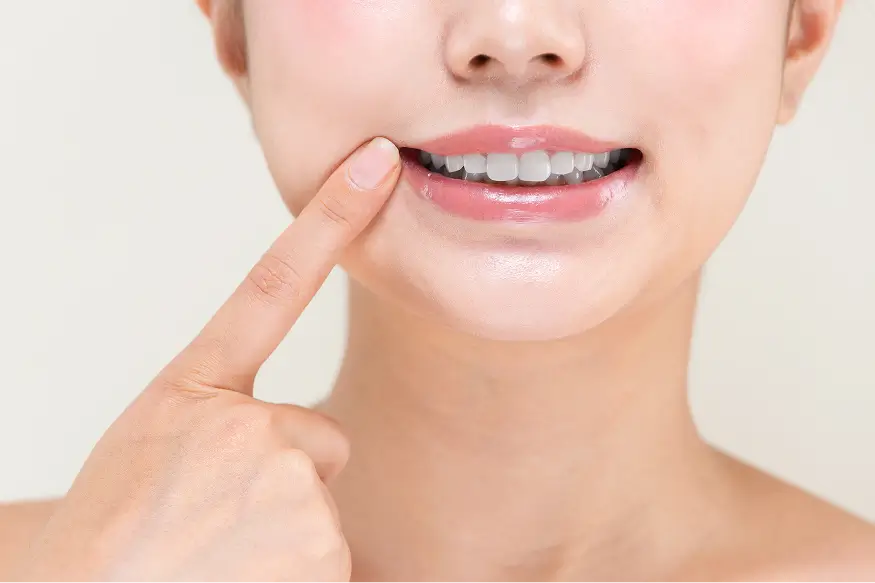 色調チェック・口腔内写真